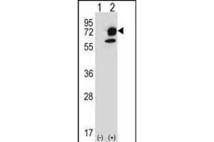 Western blot analysis of ITPKB (arrow) using rabbit polyclonal ITPKB Antibody (R38) (ABIN652430 and ABIN2842237). (ITPKB antibody  (N-Term))