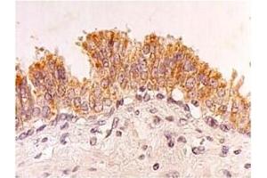 Immunohistochemistry (IHC) image for anti-Four and A Half LIM Domains 2 (FHL2) antibody (ABIN487469) (FHL2 antibody)