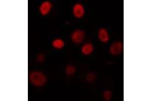 ABIN6274325 staining Hela cells by IF/ICC. (TEF antibody  (Internal Region))
