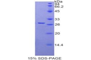 SDS-PAGE (SDS) image for Transmembrane Protease, serine 2 (TMPRSS2) (AA 284-492) protein (His tag) (ABIN2127069)