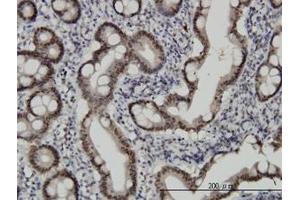 Image no. 2 for anti-Checkpoint with Forkhead and Ring Finger Domains (CHFR) (AA 1-653) antibody (ABIN599268) (CHFR antibody  (AA 1-653))