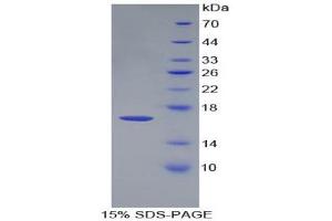 SDS-PAGE (SDS) image for Growth Differentiation Factor 3 (GDF3) (AA 253-366) protein (His tag) (ABIN2125104) (GDF3 Protein (AA 253-366) (His tag))