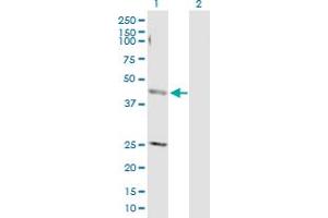 Lane 1: AP4M1 transfected lysate ( 50 KDa) Lane 2: Non-transfected lysate. (AP4M1 293T Cell Transient Overexpression Lysate(Denatured))