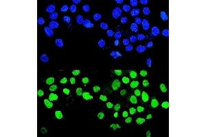 IF analysis of MMP28 using anti-MMP28 antibody (ABIN7599865). (MMP28 antibody  (AA 123-505))