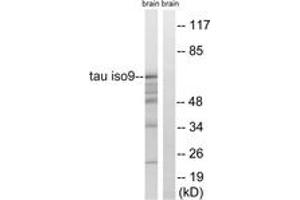 Western blot analysis of extracts from rat brain, using Tau (Ab-717/400) Antibody. (tau antibody  (AA 366-415))