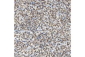 IHC analysis of SNRNP40 using anti-SNRNP40 antibody (ABIN7601719).