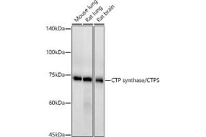 Western blot analysis of extracts of various cell lines, using CTP synthase/CTPS antibody (ABIN7266536) at 1:500 dilution. (CTP Synthase antibody)