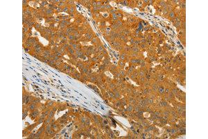 Immunohistochemistry (IHC) image for anti-USO1 Homolog, Vesicle Docking Protein (USO1) antibody (ABIN1875291) (USO1 antibody)