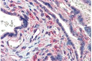 Human Placenta (formalin-fixed, paraffin-embedded) stained with LIN28 antibody ABIN462196 followed by biotinylated goat anti-rabbit IgG secondary antibody ABIN481713, alkaline phosphatase-streptavidin and chromogen. (LIN28A antibody  (N-Term))