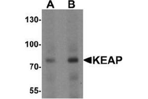 Western blot analysis of KEAP1 in human lung tissue lysate with KEAP1 Antibody  at (A) 1 and (B) 2 μg/ml. (KEAP1 antibody  (C-Term))