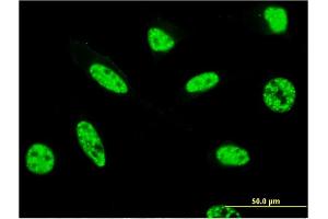 Immunofluorescence of monoclonal antibody to ZFC3H1 on HeLa cell. (ZFC3H1 antibody  (AA 1-358))