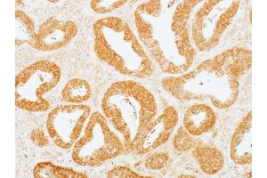 Immunohistochemistry (IHC) image for anti-Mitogen-Activated Protein Kinase Kinase 2 (MAP2K2) (AA 1-50) antibody (ABIN7454013) (Recombinant MEK2 antibody  (AA 1-50))