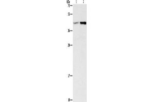 Western Blotting (WB) image for anti-Guanine Nucleotide Binding Protein (G Protein), beta 5 (GNB5) antibody (ABIN2827738) (GNB5 antibody)