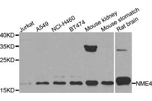 Western blot analysis of extracts of various cell lines, using NME4 antibody. (NME4 antibody)