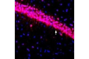 Expression of KV4. (KCND3 antibody  (Intracellular))