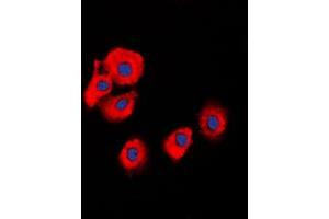 Immunofluorescence (IF) image for anti-serpin Peptidase Inhibitor, Clade B (Ovalbumin), Member 5 (SERPINB5) (Center) antibody (ABIN7296588)