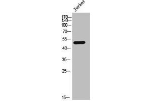 Western Blot analysis of JK cells using AR-α1A Polyclonal Antibody (alpha 1 Adrenergic Receptor antibody  (Internal Region))