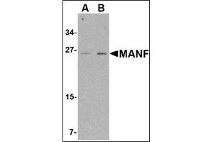 Western blot analysis of MANF in mouse brain tissue lysate with this product at (A) 1 and (B) 2 μg/ml.
