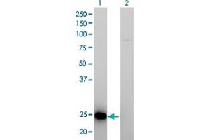 Western Blot analysis of RAB39B expression in transfected 293T cell line by RAB39B monoclonal antibody (M01), clone 1E11. (RAB39B antibody  (AA 1-213))