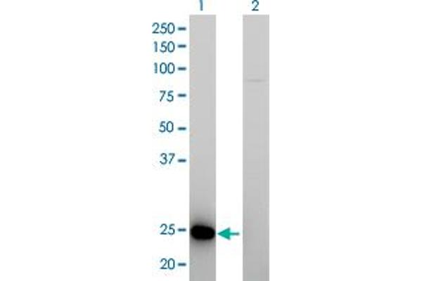 RAB39B antibody  (AA 1-213)