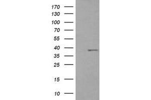 Image no. 1 for anti-CD33 (CD33) antibody (ABIN1497268) (CD33 antibody)