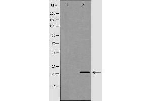 Western blot analysis of human brain lysate using CRH antibody. (CRH antibody  (N-Term))