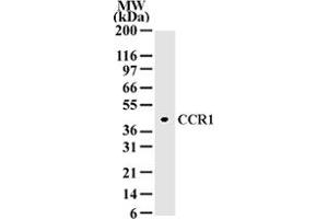 Western blot analysis of 10 ug of total cell lysate from A-375 cells with CCR1 polyclonal antibody  at 2 ug/mL dilution.