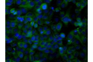 Image no. 2 for anti-Sorting Nexin 9 (SNX9) antibody (ABIN1501045) (SNX9 antibody)