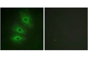 Immunofluorescence analysis of HeLa cells, using ADCY5/6 Antibody. (ADCY5/6 antibody  (AA 931-980))