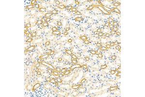 Immunohistochemistry analysis of paraffin-embedded mouse kidney using GBA (ABIN7074062) at dilution of 1: 2000