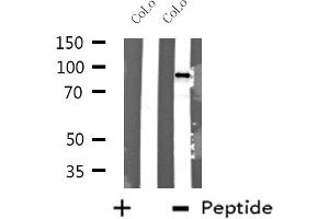Western blot analysis of extracts from CoLo cells using DDX54 antibody.