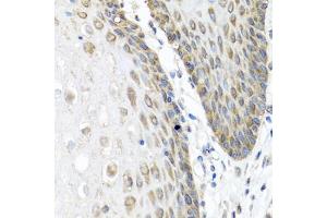 Immunohistochemistry of paraffin-embedded human esophagus using  antibody (ABIN6127432, ABIN6136873, ABIN6136875 and ABIN6223859) at dilution of 1:100 (40x lens). (Angiopoietin 1 antibody  (AA 260-400))