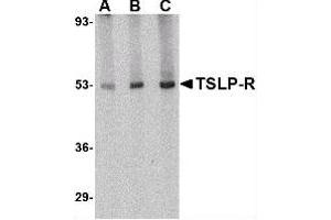 Image no. 1 for anti-Cytokine Receptor-Like Factor 2 (CRLF2) (Center) antibody (ABIN302657)