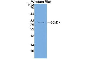 Western blot analysis of the recombinant protein. (PTPRJ antibody  (AA 1033-1277))