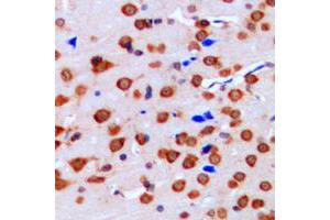 Immunohistochemistry (IHC) image for anti-Mitogen-Activated Protein Kinase 1/3 (MAPK1/3) (Center) antibody (ABIN7296708)