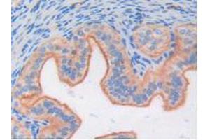 Figure. (FGF6 antibody  (AA 39-208))