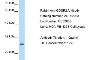 Western Blotting (WB) image for anti-Golgi SNAP Receptor Complex Member 2 (GOSR2) (N-Term) antibody (ABIN2788997) (GOSR2 antibody  (N-Term))