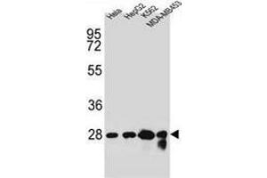 Western blot analysis in Hela, HepG2, K562, MDA-MB453 cell line lysates (35ug/lane) using Cholinephosphotransferase 1 Antibody (N-term).