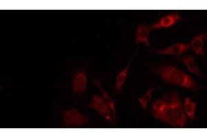 ABIN6274962 staining NIH-3T3 by IF/ICC. (CA5B antibody  (C-Term))