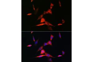 Immunofluorescence analysis of NIH-3T3 cells using RARβ Rabbit mAb (ABIN7269947) at dilution of 1:100 (40x lens). (Retinoic Acid Receptor beta antibody)