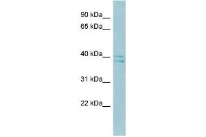 WB Suggested Anti-RAD51AP1 Antibody Titration:  0. (RAD51AP1 antibody  (Middle Region))