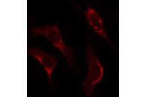 ABIN6274927 staining Hela cells by IF/ICC. (BCAS4 antibody)