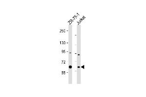 All lanes : Anti-M1D Antibody (Center) at 1:1000 dilution Lane 1: ZR-75-1 whole cell lysate Lane 2: Jurkat whole cell lysate Lysates/proteins at 20 μg per lane. (PPM1D antibody  (AA 183-212))