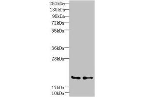 Western blot All lanes: C20orf27 antibody at 6 μg/mL Lane 1: HCT116 whole cell lysate Lane 2: MDA-MB-231 whole cell lysate Secondary Goat polyclonal to rabbit IgG at 1/10000 dilution Predicted band size: 20, 22 kDa Observed band size: 20 kDa