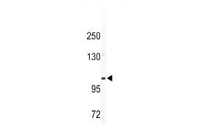 Western blot analysis of CD49e antibody (C-term) (ABIN389403 and ABIN2839492) in mouse bladder tissue lysates (35 μg/lane). (ITGA5 antibody  (C-Term))