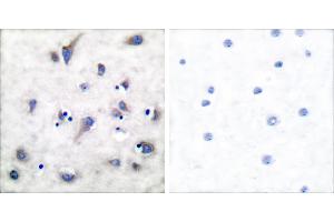 P-peptide - + (DARPP32 antibody  (pThr34))