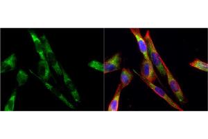 ICC/IF Image Tyrosine Hydroxylase antibody [N1C1] detects Tyrosine Hydroxylase protein at cytoplasm by immunofluorescent analysis.