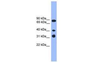 Image no. 1 for anti-Lymphocyte Transmembrane Adaptor 1 (LAX1) (C-Term) antibody (ABIN6745351) (LAX1 antibody  (C-Term))