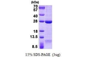 Image no. 1 for Dynein, Axonemal, Light Chain 1 (DNAL1) protein (His tag) (ABIN1098771) (DNAL1 Protein (His tag))