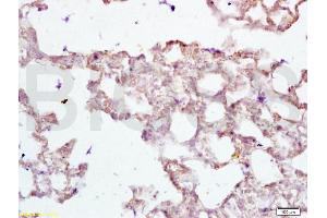 Formalin-fixed and paraffin embedded rat lung tissue labeled with Anti-PAX2 Polyclonal Antibody, Unconjugated (ABIN738951) at 1:200 followed by conjugation to the secondary antibody and DAB staining (PAX2A antibody)
